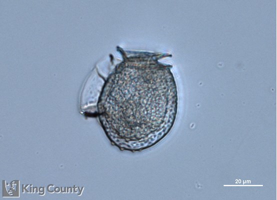Photo of Dinophysis acuminata